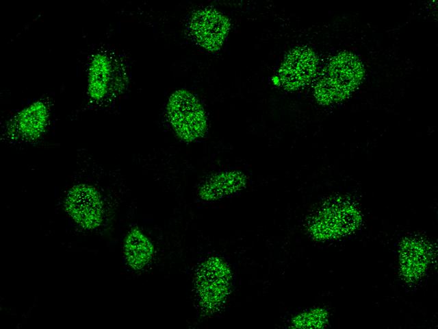 RING1 Antibody - Immunofluorescence staining of RING1 in HeLa cells. Cells were fixed with 4% PFA, permeabilzed with 0.3% Triton X-100 in PBS, blocked with 10% serum, and incubated with rabbit anti-human RING1 polyclonal antibody (dilution ratio: 1:5000) at 4°C overnight. Then cells were stained with the Alexa Fluor 488-conjugated Goat Anti-rabbit IgG secondary antibody (green). Positive staining was localized to nucleus.