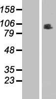 RINT1 Protein - Western validation with an anti-DDK antibody * L: Control HEK293 lysate R: Over-expression lysate