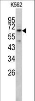RIOK1 Antibody - Western blot of RIOK1 antibody in K562 cell line lysates (35 ug/lane). RIOK1 (arrow) was detected using the purified antibody.