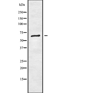 RIOK1 Antibody - Western blot analysis of RIOK1 using HeLa whole cells lysates