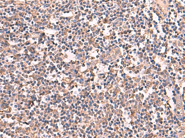 RIOK1 Antibody - Immunohistochemistry of paraffin-embedded Human tonsil tissue  using RIOK1 Polyclonal Antibody at dilution of 1:60(×200)