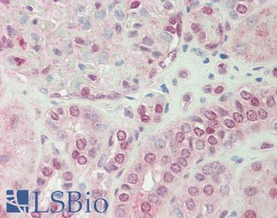 RIOK2 Antibody - Human Kidney: Formalin-Fixed, Paraffin-Embedded (FFPE).  This image was taken for the unconjugated form of this product. Other forms have not been tested.