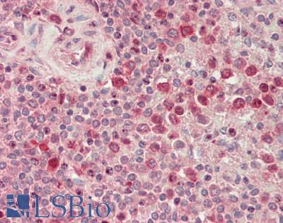 RIOK2 Antibody - Human Spleen: Formalin-Fixed, Paraffin-Embedded (FFPE).  This image was taken for the unconjugated form of this product. Other forms have not been tested.