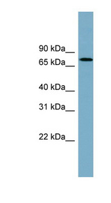 RIOK2 Antibody - Anti-RIOK2 antibody western blot of Human fetal heart lysate.  This image was taken for the unconjugated form of this product. Other forms have not been tested.