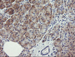 RIOK2 Antibody - IHC of paraffin-embedded Human pancreas tissue using anti-RIOK2 mouse monoclonal antibody.