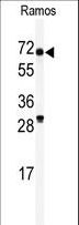 RIOK2 Antibody - Western blot of anti-RIOK2 Antibody in Ramos cell line lysates (35 ug/lane). RIOK2(arrow) was detected using the purified antibody.