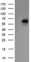 RIOK2 Antibody - HEK293T cells were transfected with the pCMV6-ENTRY control (Left lane) or pCMV6-ENTRY RIOK2 (Right lane) cDNA for 48 hrs and lysed. Equivalent amounts of cell lysates (5 ug per lane) were separated by SDS-PAGE and immunoblotted with anti-RIOK2.