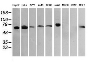 RIOK2 Antibody - Western blot of extracts (35 ug) from 9 different cell lines by using g anti-RIOK2 monoclonal antibody (HepG2: human; HeLa: human; SVT2: mouse; A549: human; COS7: monkey; Jurkat: human; MDCK: canine; PC12: rat; MCF7: human).