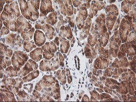 RIOK2 Antibody - IHC of paraffin-embedded Human pancreas tissue using anti-RIOK2 mouse monoclonal antibody.