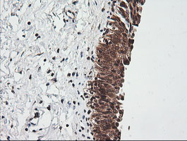 RIOK2 Antibody - IHC of paraffin-embedded Human bladder tissue using anti-RIOK2 mouse monoclonal antibody.