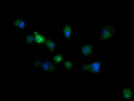 RIOK2 Antibody - Anti-RIOK2 mouse monoclonal antibody immunofluorescent staining of COS7 cells transiently transfected by pCMV6-ENTRY RIOK2.