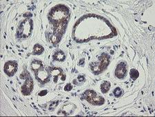 RIOK2 Antibody - IHC of paraffin-embedded Human breast tissue using anti-RIOK2 mouse monoclonal antibody.
