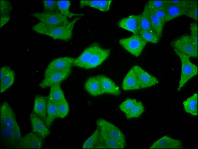 RIOK2 Antibody - Immunofluorescence staining of HepG2 cells diluted at 1:133, counter-stained with DAPI. The cells were fixed in 4% formaldehyde, permeabilized using 0.2% Triton X-100 and blocked in 10% normal Goat Serum. The cells were then incubated with the antibody overnight at 4°C.The Secondary antibody was Alexa Fluor 488-congugated AffiniPure Goat Anti-Rabbit IgG (H+L).