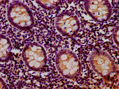 RIOK2 Antibody - Immunohistochemistry Dilution at 1:400 and staining in paraffin-embedded human appendix tissue performed on a Leica BondTM system. After dewaxing and hydration, antigen retrieval was mediated by high pressure in a citrate buffer (pH 6.0). Section was blocked with 10% normal Goat serum 30min at RT. Then primary antibody (1% BSA) was incubated at 4°C overnight. The primary is detected by a biotinylated Secondary antibody and visualized using an HRP conjugated SP system.