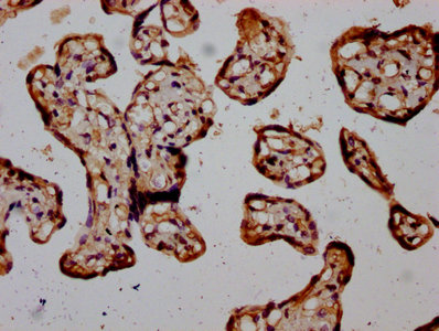 RIOK2 Antibody - Immunohistochemistry Dilution at 1:400 and staining in paraffin-embedded human placenta tissue performed on a Leica BondTM system. After dewaxing and hydration, antigen retrieval was mediated by high pressure in a citrate buffer (pH 6.0). Section was blocked with 10% normal Goat serum 30min at RT. Then primary antibody (1% BSA) was incubated at 4°C overnight. The primary is detected by a biotinylated Secondary antibody and visualized using an HRP conjugated SP system.