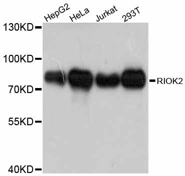 RIOK2 Antibody - Western blot analysis of extracts of various cell lines, using RIOK2 antibody at 1:3000 dilution. The secondary antibody used was an HRP Goat Anti-Rabbit IgG (H+L) at 1:10000 dilution. Lysates were loaded 25ug per lane and 3% nonfat dry milk in TBST was used for blocking. An ECL Kit was used for detection and the exposure time was 90s.