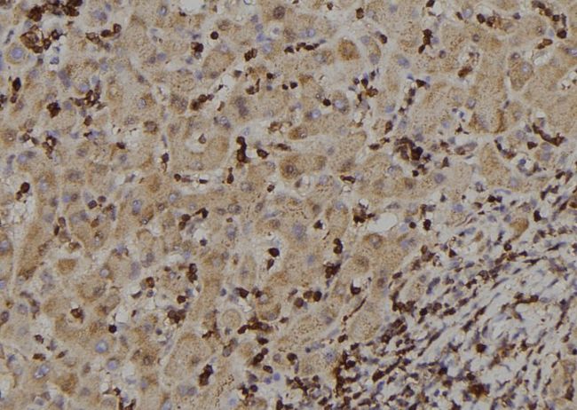 RIOK2 Antibody - 1:100 staining human liver tissue by IHC-P. The sample was formaldehyde fixed and a heat mediated antigen retrieval step in citrate buffer was performed. The sample was then blocked and incubated with the antibody for 1.5 hours at 22°C. An HRP conjugated goat anti-rabbit antibody was used as the secondary.