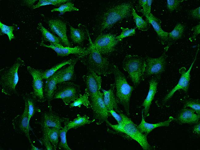 RIOK2 Antibody - Immunofluorescence staining of RIOK2 in U251MG cells. Cells were fixed with 4% PFA, permeabilzed with 0.1% Triton X-100 in PBS, blocked with 10% serum, and incubated with rabbit anti-Human RIOK2 polyclonal antibody (dilution ratio 1:200) at 4°C overnight. Then cells were stained with the Alexa Fluor 488-conjugated Goat Anti-rabbit IgG secondary antibody (green) and counterstained with DAPI (blue). Positive staining was localized to Cytoplasm.