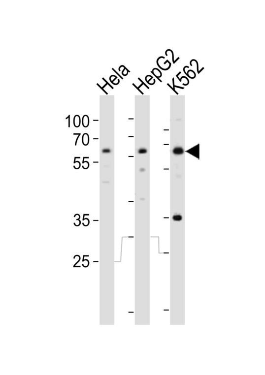 RIOK3 Antibody - Western blot of lysates from HeLa, HepG2, K562 cell line (from left to right), using RIOK3 antibody diluted at 1:1000 at each lane. A goat anti-rabbit IgG H&L (HRP) at 1:10000 dilution was used as the secondary antibody. Lysates at 20 ug per lane.