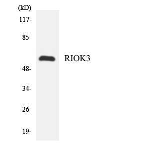 RIOK3 Antibody - Western blot analysis of the lysates from HeLa cells using RIOK3 antibody.