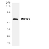 RIOK3 Antibody - Western blot analysis of the lysates from HeLa cells using RIOK3 antibody.