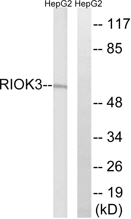RIOK3 Antibody - Western blot analysis of lysates from HepG2 cells, using RIOK3 Antibody. The lane on the right is blocked with the synthesized peptide.