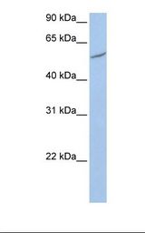 RIOK3 Antibody - 721_B cell lysate. Antibody concentration: 1.0 ug/ml. Gel concentration: 12%.  This image was taken for the unconjugated form of this product. Other forms have not been tested.