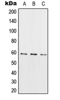 RIOK3 Antibody - Western blot analysis of RIOK3 expression in HeLa (A); Raw264.7 (B); H9C2 (C) whole cell lysates.