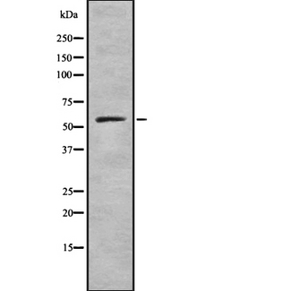 RIOK3 Antibody - Western blot analysis of RIOK3 using K562 whole cells lysates