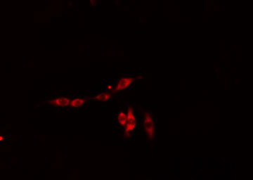 RIOK3 Antibody - Staining HepG2 cells by IF/ICC. The samples were fixed with PFA and permeabilized in 0.1% Triton X-100, then blocked in 10% serum for 45 min at 25°C. The primary antibody was diluted at 1:200 and incubated with the sample for 1 hour at 37°C. An Alexa Fluor 594 conjugated goat anti-rabbit IgG (H+L) antibody, diluted at 1/600, was used as secondary antibody.