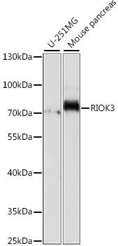 RIOK3 Antibody - Western blot analysis of extracts of various cell lines using RIOK3 Polyclonal Antibody at dilution of 1:1000.