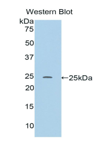 RIP1 / RALBP1 Antibody - Western blot of recombinant RIP1 / RALBP1.  This image was taken for the unconjugated form of this product. Other forms have not been tested.