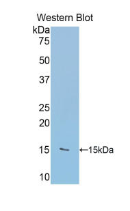 RIP1 / RALBP1 Antibody - Western blot of recombinant RIP1 / RALBP1.  This image was taken for the unconjugated form of this product. Other forms have not been tested.