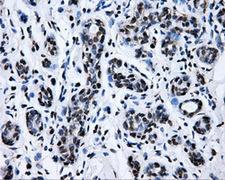 RIP1 / RALBP1 Antibody - IHC of paraffin-embedded breast tissue using anti-RALBP1 mouse monoclonal antibody. (Dilution 1:50).