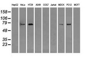 RIP1 / RALBP1 Antibody - Western blot of extracts (35 ug) from 9 different cell lines by using anti-RALBP1 monoclonal antibody.