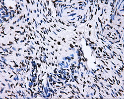 RIP1 / RALBP1 Antibody - IHC of paraffin-embedded Ovary tissue using anti-RALBP1 mouse monoclonal antibody. (Dilution 1:50).