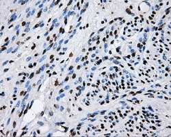 RIP1 / RALBP1 Antibody - IHC of paraffin-embedded endometrium tissue using anti-RALBP1 mouse monoclonal antibody. (Dilution 1:50).