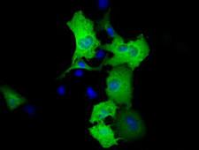 RIP1 / RALBP1 Antibody - Anti-RALBP1 mouse monoclonal antibody  immunofluorescent staining of COS7 cells transiently transfected by pCMV6-ENTRY RALBP1.