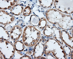 RIP1 / RALBP1 Antibody - Immunohistochemical staining of paraffin-embedded Kidney tissue using anti-RALBP1 mouse monoclonal antibody. (Dilution 1:50).