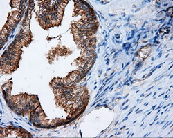 RIP1 / RALBP1 Antibody - Immunohistochemical staining of paraffin-embedded prostate tissue using anti-RALBP1 mouse monoclonal antibody. (Dilution 1:50).