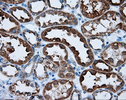 RIP1 / RALBP1 Antibody - IHC of paraffin-embedded Kidney tissue using anti-RALBP1 mouse monoclonal antibody. (Dilution 1:50).