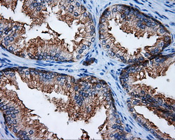 RIP1 / RALBP1 Antibody - IHC of paraffin-embedded prostate tissue using anti-RALBP1 mouse monoclonal antibody. (Dilution 1:50).