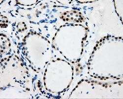 RIP1 / RALBP1 Antibody - IHC of paraffin-embedded thyroid tissue using anti-RALBP1 mouse monoclonal antibody. (Dilution 1:50).