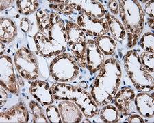 RIP1 / RALBP1 Antibody - IHC of paraffin-embedded Kidney tissue using anti-RALBP1 mouse monoclonal antibody. (Dilution 1:50).