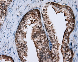 RIP1 / RALBP1 Antibody - IHC of paraffin-embedded prostate tissue using anti-RALBP1 mouse monoclonal antibody. (Dilution 1:50).