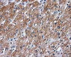 RIP1 / RALBP1 Antibody - IHC of paraffin-embedded liver tissue using anti-RALBP1 mouse monoclonal antibody. (Dilution 1:50).