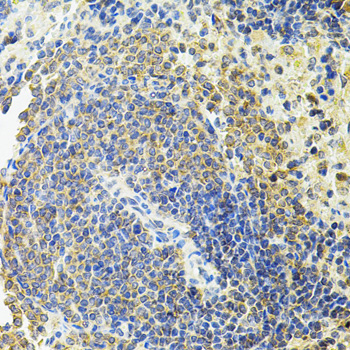 RIP1 / RALBP1 Antibody - Immunohistochemistry of paraffin-embedded rat spleen using RALBP1 antibodyat dilution of 1:100 (40x lens).