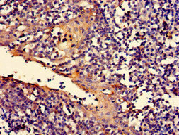 RIP1 / RALBP1 Antibody - Immunohistochemistry of paraffin-embedded human tonsil tissue at dilution of 1:100