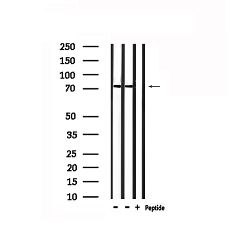 RIP1 / RALBP1 Antibody - Western blot analysis of extracts of mouse brain tissue using RALBP1 antibody. Lane 1 was treated with the antigen-specific peptide.