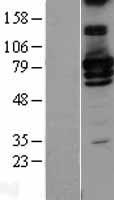 RIP1 / RALBP1 Protein - Western validation with an anti-DDK antibody * L: Control HEK293 lysate R: Over-expression lysate